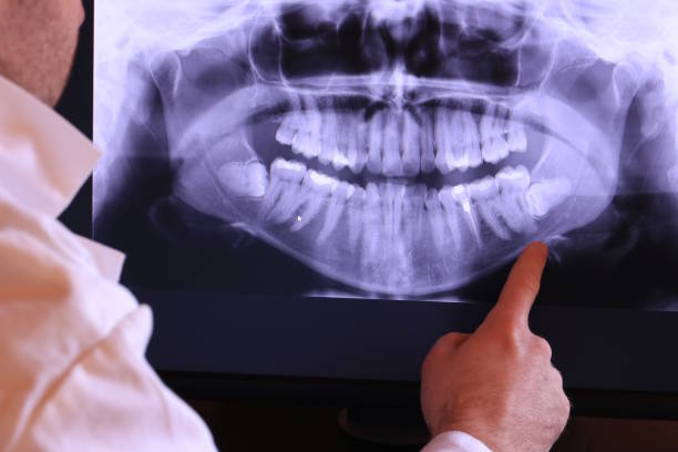 Best Emergency Treatment for Oral Infections in Lewistown, MT